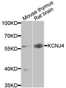 KCNJ4 / Kir2.3 Antibody - Western blot analysis of extracts of various cells.