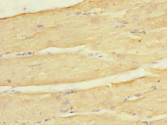KCNJ4 / Kir2.3 Antibody - Immunohistochemistry of paraffin-embedded human skeletal muscle tissue at dilution 1:100