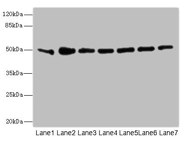 KCNJ4 / Kir2.3 Antibody - Western blot All Lanes: KCNJ4 antibody at 2.04ug/ml Lane 1: Rat heart tissue Lane 2: A549 whole cell lysate Lane 3: Hela whole cell lysate Lane 4: 293T whole cell lysate Lane 5: HepG-2 whole cell lysate Lane 6: Jurkat whole cell lysate Lane 7: MCF7 whole cell lysate Secondary Goat polyclonal to rabbit IgG at 1/10000 dilution Predicted band size: 50 kDa Observed band size: 50 kDa