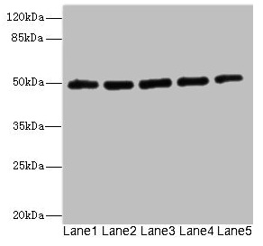 KCNJ4 / Kir2.3 Antibody - Western blot All lanes: KCNJ4 antibody at 2.04µg/ml Lane 1: Hela whole cell lysate Lane 2: 293T whole cell lysate Lane 3: HepG2 whole cell lysate Lane 4: Jurkat whole cell lysate Lane 5: MCF-7 whole cell lysate Secondary Goat polyclonal to rabbit IgG at 1/10000 dilution Predicted band size: 50 kDa Observed band size: 50 kDa