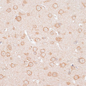 KCNJ4 / Kir2.3 Antibody - Immunohistochemistry of paraffin-embedded rat brain using KCNJ4 antibody at dilution of 1:100 (40x lens).