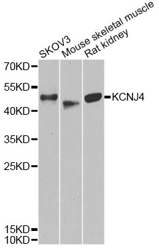 KCNJ4 / Kir2.3 Antibody - Western blot analysis of extracts of various cell lines, using KCNJ4 antibody at 1:1000 dilution. The secondary antibody used was an HRP Goat Anti-Rabbit IgG (H+L) at 1:10000 dilution. Lysates were loaded 25ug per lane and 3% nonfat dry milk in TBST was used for blocking. An ECL Kit was used for detection and the exposure time was 30s.