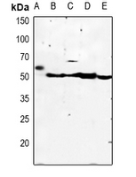 KCNJ4 / Kir2.3 Antibody - Western blot analysis of Kir2.3 expression in HEK293T (A), Hela (B), mouse heart (C), mouse brain (D), rat brain (E) whole cell lysates.