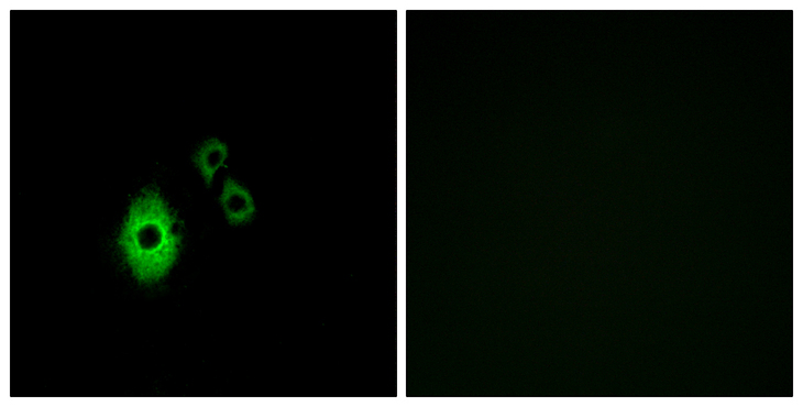 KCNJ5 / Kir3.4 / GIRK4 Antibody - Immunofluorescence analysis of A549 cells, using KCNJ5 Antibody. The picture on the right is blocked with the synthesized peptide.