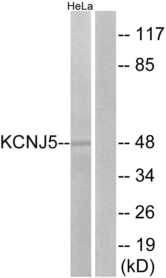 KCNJ5 / Kir3.4 / GIRK4 Antibody - Western blot analysis of lysates from HeLa cells, using KCNJ5 Antibody. The lane on the right is blocked with the synthesized peptide.