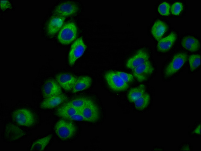 KCNJ5 / Kir3.4 / GIRK4 Antibody - Immunofluorescence staining of A549 cells at a dilution of 1:100, counter-stained with DAPI. The cells were fixed in 4% formaldehyde, permeabilized using 0.2% Triton X-100 and blocked in 10% normal Goat Serum. The cells were then incubated with the antibody overnight at 4 °C.The secondary antibody was Alexa Fluor 488-congugated AffiniPure Goat Anti-Rabbit IgG (H+L) .