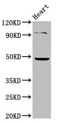 KCNJ5 / Kir3.4 / GIRK4 Antibody - Positive Western Blot detected in Mouse heart tissue. All lanes: KCNJ5 antibody at 4.85 µg/ml Secondary Goat polyclonal to rabbit IgG at 1/50000 dilution. Predicted band size: 48 KDa. Observed band size: 48 KDa