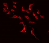 KCNJ5 / Kir3.4 / GIRK4 Antibody - Staining HeLa cells by IF/ICC. The samples were fixed with PFA and permeabilized in 0.1% Triton X-100, then blocked in 10% serum for 45 min at 25°C. The primary antibody was diluted at 1:200 and incubated with the sample for 1 hour at 37°C. An Alexa Fluor 594 conjugated goat anti-rabbit IgG (H+L) Ab, diluted at 1/600, was used as the secondary antibody.