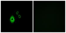 KCNJ5 / Kir3.4 / GIRK4 Antibody - Peptide - + Immunofluorescence analysis of A549 cells, using KCNJ5 antibody.