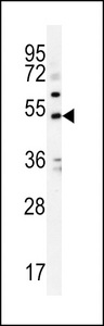 KCNJ6 / GIRK2 Antibody - KCNJ6 Antibody western blot of K562 cell line lysates (35 ug/lane). The KCNJ6 antibody detected the KCNJ6 protein (arrow).