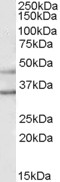 KCNJ6 / GIRK2 Antibody - Antibody (1 ug/ml) staining of Human Brain (Substantia Nigra) lysate (35 ug protein in RIPA buffer). Primary incubation was 1 hour. Detected by chemiluminescence.