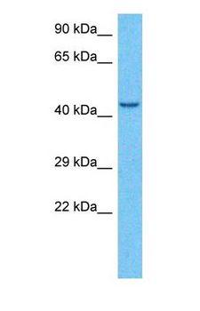 KCNJ6 / GIRK2 Antibody - Western blot of KCNJ6 Antibody with human MCF7 Whole Cell lysate.  This image was taken for the unconjugated form of this product. Other forms have not been tested.