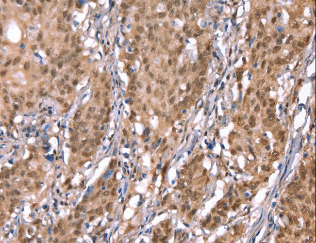KCNJ6 / GIRK2 Antibody - Immunohistochemistry of paraffin-embedded Human brain using KCNJ6 Polyclonal Antibody at dilution of 1:40.
