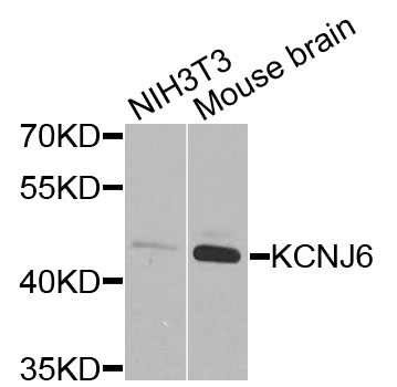 KCNJ6 / GIRK2 Antibody - Western blot analysis of extracts of various cells.