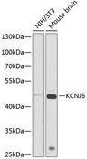 KCNJ6 / GIRK2 Antibody - Western blot analysis of extracts of various cell lines using KCNJ6 Polyclonal Antibody at dilution of 1:1000.