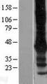 KCNJ6 / GIRK2 Protein - Western validation with an anti-DDK antibody * L: Control HEK293 lysate R: Over-expression lysate