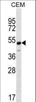 KCNJ8 / Kir6.1 Antibody - KCNJ8 Antibody western blot of CEM cell line lysates (35 ug/lane). The KCNJ8 antibody detected the KCNJ8 protein (arrow).