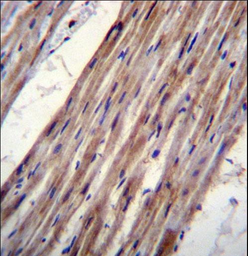 KCNJ8 / Kir6.1 Antibody - KCNJ8 Antibody immunohistochemistry of formalin-fixed and paraffin-embedded human heart tissue followed by peroxidase-conjugated secondary antibody and DAB staining.