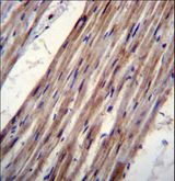 KCNJ8 / Kir6.1 Antibody - KCNJ8 Antibody immunohistochemistry of formalin-fixed and paraffin-embedded human heart tissue followed by peroxidase-conjugated secondary antibody and DAB staining.