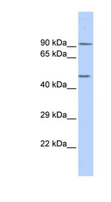 KCNJ8 / Kir6.1 Antibody - KCNJ8 / Kir6.1 antibody Western blot of HeLa lysate. This image was taken for the unconjugated form of this product. Other forms have not been tested.