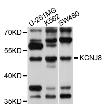 KCNJ8 / Kir6.1 Antibody - Western blot analysis of extracts of various cell lines, using KCNJ8 antibody at 1:1000 dilution. The secondary antibody used was an HRP Goat Anti-Rabbit IgG (H+L) at 1:10000 dilution. Lysates were loaded 25ug per lane and 3% nonfat dry milk in TBST was used for blocking. An ECL Kit was used for detection and the exposure time was 5s.