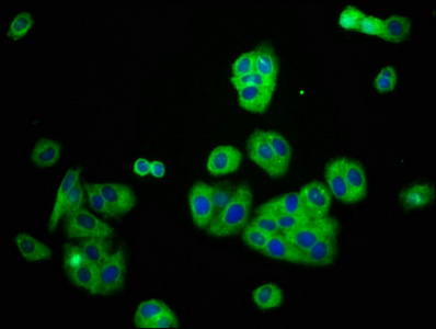 KCNJ8 / Kir6.1 Antibody - Immunofluorescence staining of HepG2 cells at a dilution of 1:166, counter-stained with DAPI. The cells were fixed in 4% formaldehyde, permeabilized using 0.2% Triton X-100 and blocked in 10% normal Goat Serum. The cells were then incubated with the antibody overnight at 4 °C.The secondary antibody was Alexa Fluor 488-congugated AffiniPure Goat Anti-Rabbit IgG (H+L) .
