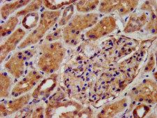 KCNJ8 / Kir6.1 Antibody - Immunohistochemistry image at a dilution of 1:500 and staining in paraffin-embedded human kidney tissue performed on a Leica BondTM system. After dewaxing and hydration, antigen retrieval was mediated by high pressure in a citrate buffer (pH 6.0) . Section was blocked with 10% normal goat serum 30min at RT. Then primary antibody (1% BSA) was incubated at 4 °C overnight. The primary is detected by a biotinylated secondary antibody and visualized using an HRP conjugated SP system.