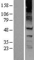 KCNJ8 / Kir6.1 Protein - Western validation with an anti-DDK antibody * L: Control HEK293 lysate R: Over-expression lysate