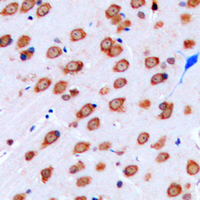KCNJ9 / Kir3.3 / GIRK3 Antibody - Immunohistochemical analysis of Kir3.3 staining in human brain formalin fixed paraffin embedded tissue section. The section was pre-treated using heat mediated antigen retrieval with sodium citrate buffer (pH 6.0). The section was then incubated with the antibody at room temperature and detected using an HRP conjugated compact polymer system. DAB was used as the chromogen. The section was then counterstained with hematoxylin and mounted with DPX.