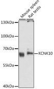 KCNK10 / TREK Antibody - Western blot analysis of extracts of various cell lines, using KCNK10 antibody at 1:3000 dilution. The secondary antibody used was an HRP Goat Anti-Rabbit IgG (H+L) at 1:10000 dilution. Lysates were loaded 25ug per lane and 3% nonfat dry milk in TBST was used for blocking. An ECL Kit was used for detection and the exposure time was 60s.