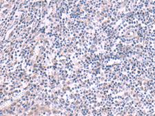 KCNK10 / TREK Antibody - Immunohistochemistry of paraffin-embedded Human tonsil tissue  using KCNK10 Polyclonal Antibody at dilution of 1:45(×200)