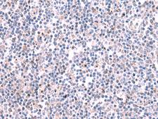 KCNK10 / TREK Antibody - Immunohistochemistry of paraffin-embedded Human tonsil tissue  using KCNK10 Polyclonal Antibody at dilution of 1:35(×200)