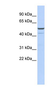 KCNK12 Antibody - KCNK12 antibody Western blot of OVCAR-3 cell lysate. This image was taken for the unconjugated form of this product. Other forms have not been tested.