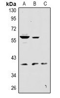 KCNK12 Antibody - Western blot analysis of KCNK12 expression in Hela (A), PC12 (B), CT26 (C) whole cell lysates.