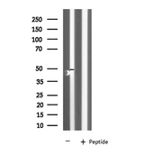 KCNK12 Antibody - Western blot analysis of extracts of rat muscle using KCNK12 antibody.