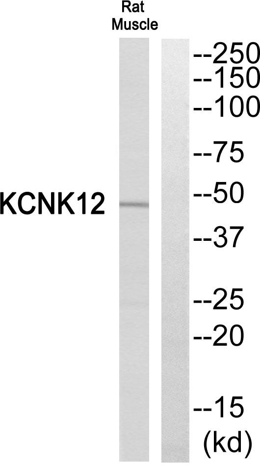 KCNK12 Antibody - Western blot analysis of extracts from Rat Muscle cells, using KCNK12 antibody.