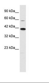 KCNK13 / THIK-1 Antibody - Jurkat Cell Lysate.  This image was taken for the unconjugated form of this product. Other forms have not been tested.