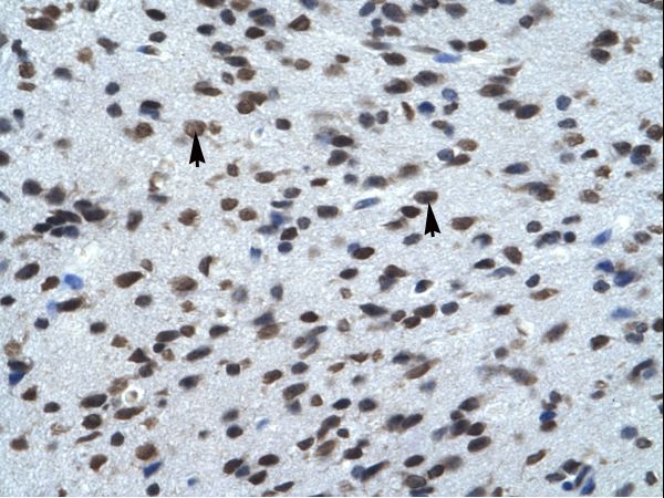 KCNK13 / THIK-1 Antibody - Human Brain.  This image was taken for the unconjugated form of this product. Other forms have not been tested.