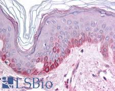 KCNK13 / THIK-1 Antibody - Anti-KCNK13 antibody IHC of human skin. Immunohistochemistry of formalin-fixed, paraffin-embedded tissue after heat-induced antigen retrieval. Antibody concentration 5 ug/ml.  This image was taken for the unconjugated form of this product. Other forms have not been tested.