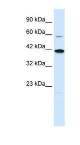 KCNK13 / THIK-1 Antibody - KCNK13 antibody Western blot of Jurkat lysate. This image was taken for the unconjugated form of this product. Other forms have not been tested.