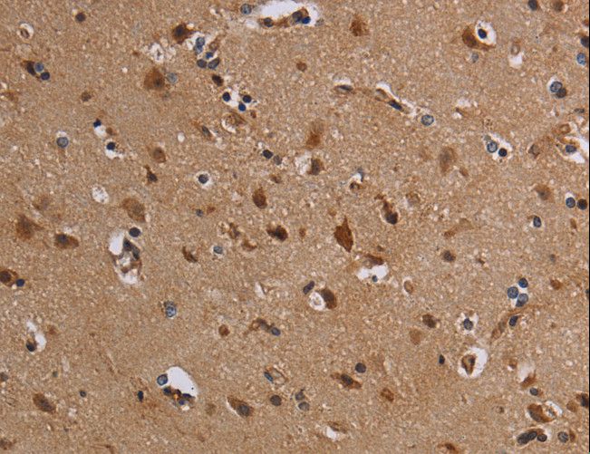 KCNK13 / THIK-1 Antibody - Immunohistochemistry of paraffin-embedded Human brain using KCNK13 Polyclonal Antibody at dilution of 1:50.