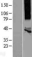 KCNK13 / THIK-1 Protein - Western validation with an anti-DDK antibody * L: Control HEK293 lysate R: Over-expression lysate
