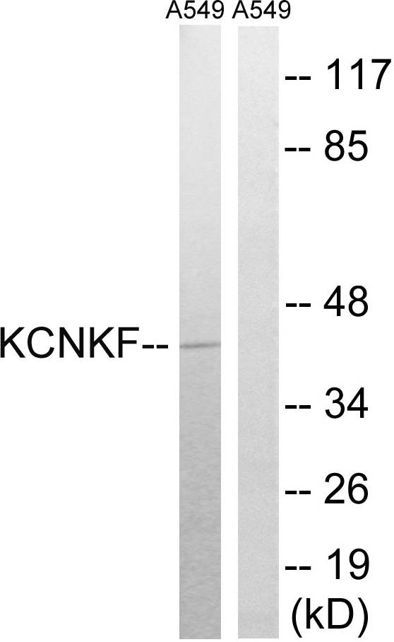 KCNK15 Antibody - Western blot analysis of lysates from A549 cells, using KCNK15 Antibody. The lane on the right is blocked with the synthesized peptide.