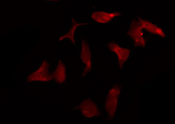 KCNK15 Antibody - Staining A549 cells by IF/ICC. The samples were fixed with PFA and permeabilized in 0.1% Triton X-100, then blocked in 10% serum for 45 min at 25°C. The primary antibody was diluted at 1:200 and incubated with the sample for 1 hour at 37°C. An Alexa Fluor 594 conjugated goat anti-rabbit IgG (H+L) Ab, diluted at 1/600, was used as the secondary antibody.