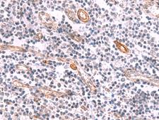 KCNK15 Antibody - Immunohistochemistry of paraffin-embedded Human tonsil tissue  using KCNK15 Polyclonal Antibody at dilution of 1:45(×200)