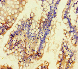 KCNK16 / TALK-1 Antibody - Immunohistochemistry of paraffin-embedded human small intestine tissue at dilution of 1:100