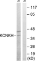 KCNK17 Antibody - Western blot analysis of lysates from Jurkat cells, using KCNK17 Antibody. The lane on the right is blocked with the synthesized peptide.