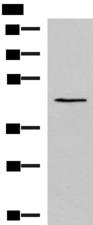 KCNK18 / TRESK Antibody - Western blot analysis of TM4 cell lysate  using KCNK18 Polyclonal Antibody at dilution of 1:800
