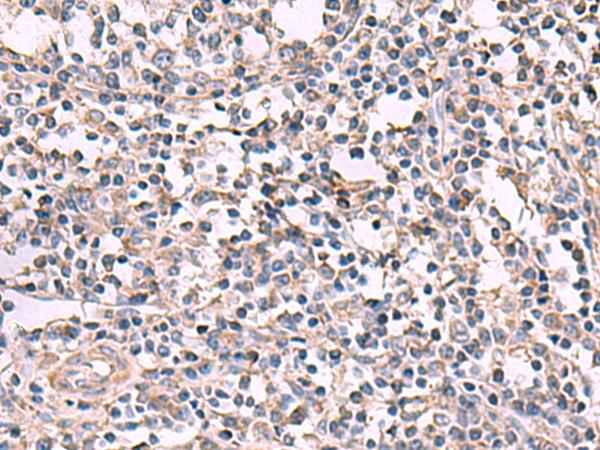 KCNK18 / TRESK Antibody - Immunohistochemistry of paraffin-embedded Human tonsil tissue  using KCNK18 Polyclonal Antibody at dilution of 1:80(×200)