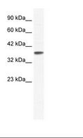 KCNK3 / OAT1 Antibody - Jurkat Cell Lysate.  This image was taken for the unconjugated form of this product. Other forms have not been tested.